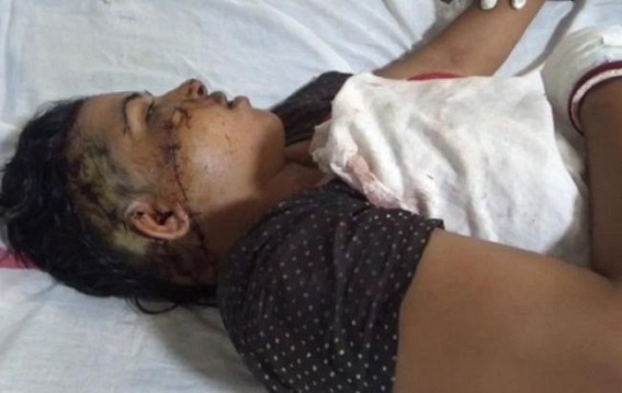 Brutal Domestic Torture on a Housewife at Kamalpur Brutal Domestic Torture on a Housewife at Kamalpur